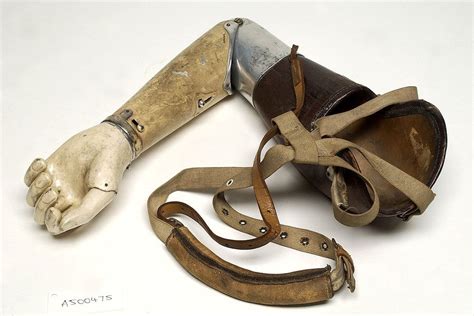 artificial limbs of the tudor period